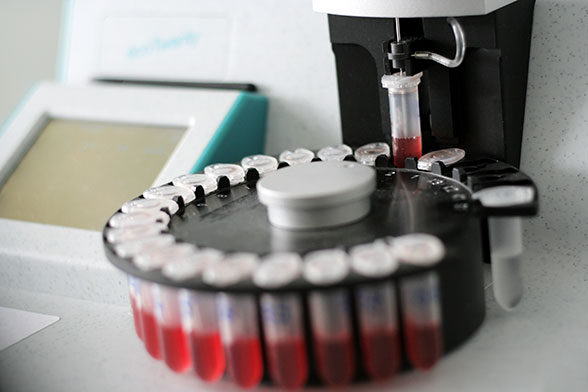 Krvni test - odvzem krvi