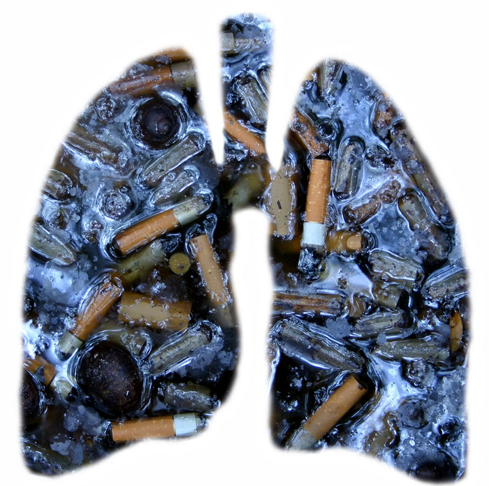 Bolezni zaradi kajenja
