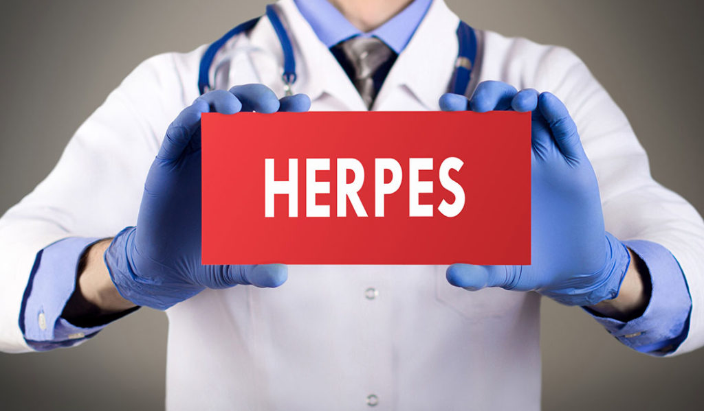 Genitalni herpes