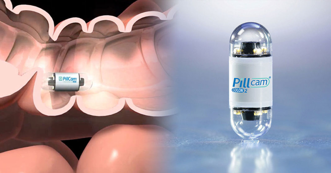 Kamera v kapsuli za kolonoskopijo