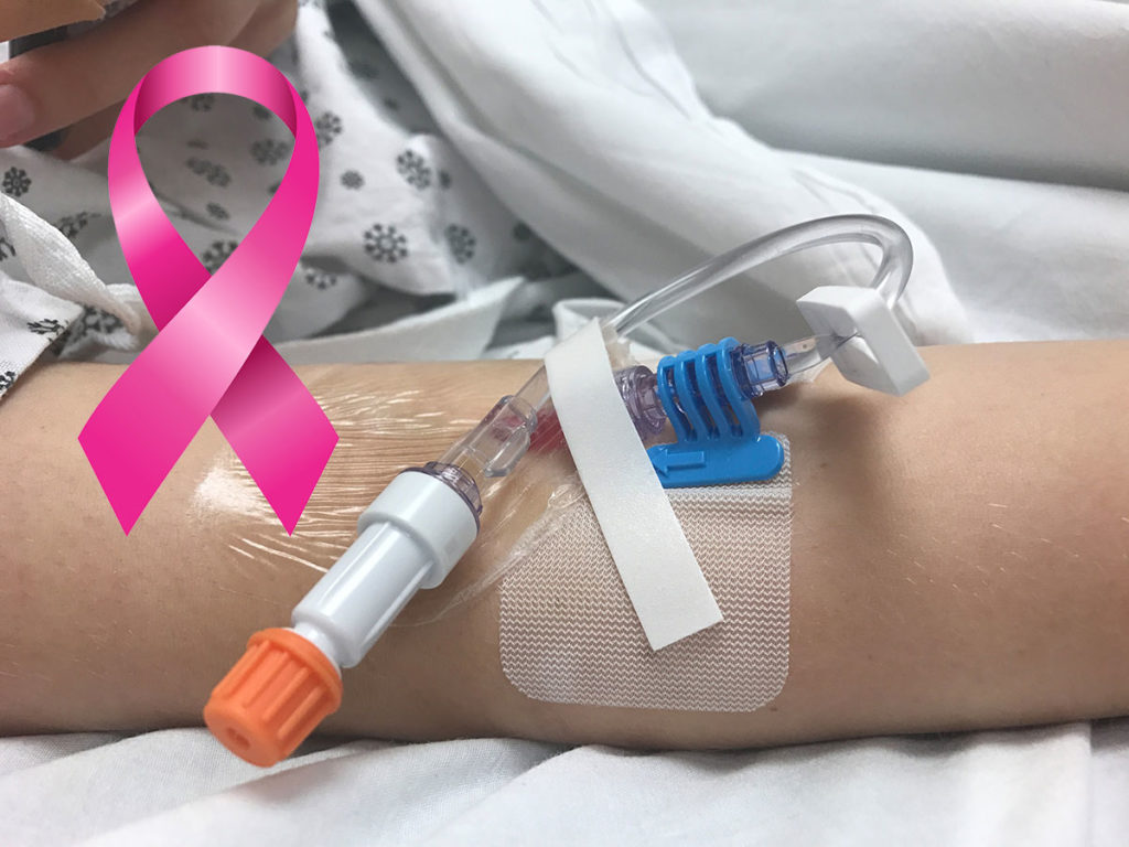 Test za zgodnje odkrivanje raka na dojkah