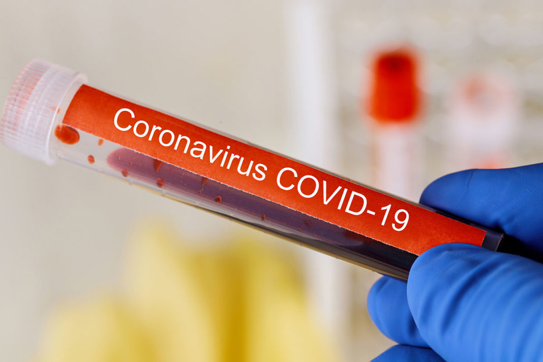 Koronavirus covid-19 diabetes