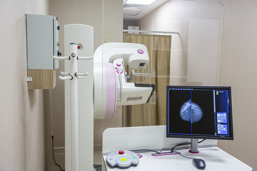 Umetna inteligenca pomaga pri zgodnejšem odkrivanju raka dojk