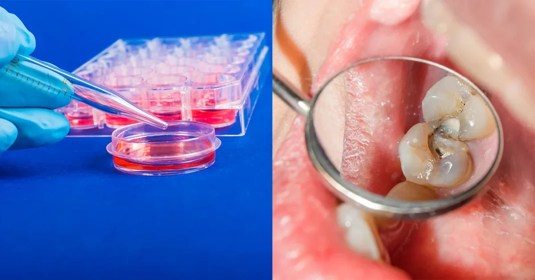 Regeneracija zob s pomočjo matičnih celic