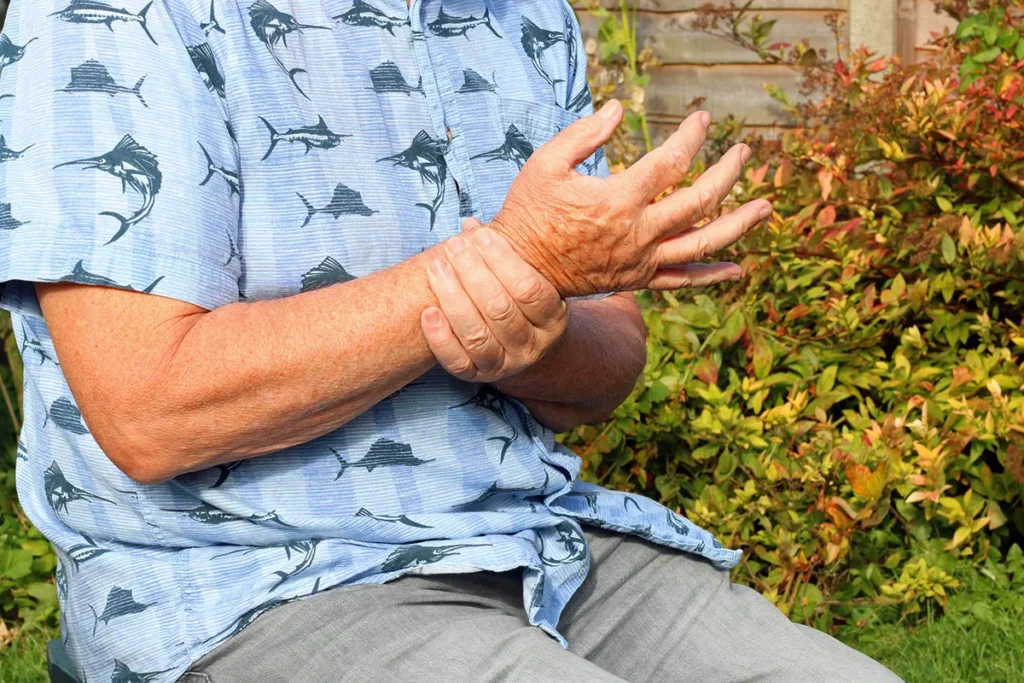 Bolečine v sklepih: Naravne naturopatske rešitve 2 Kaj pomaga pri bolečinah v sklepih